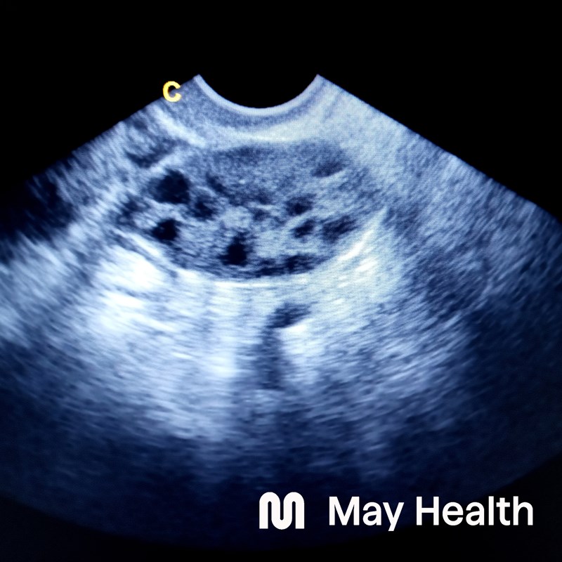 May Health B web